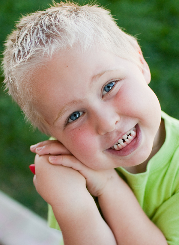 Teeth that meet in an abnormal way or don't meet at all Teeth that meet in an abnormal way or don't meet at all