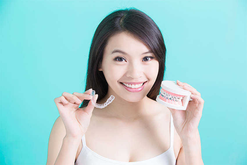 Clear Aligners