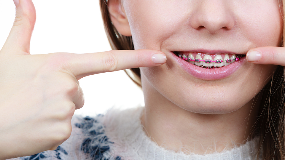 Find a Certified HSO Orthodontist Near You Find a Certified HSO Orthodontist Near You